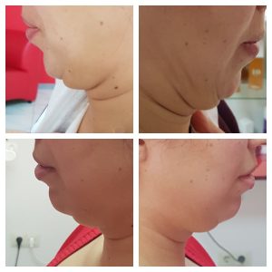 photo5204430710193109313