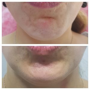 photo5204430710193109324