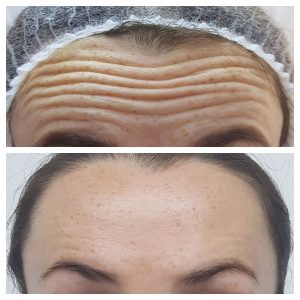 photo5204430710193109325