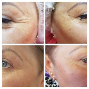 photo5204430710193109330