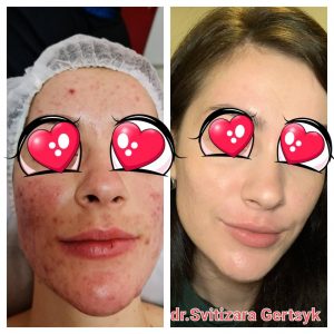 изображение_viber_2021-11-17_15-54-29-496