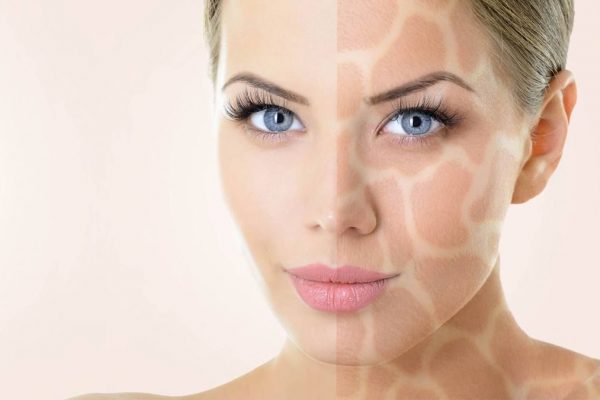 d9e8b294f68db7dbc24b9a982b80eeef