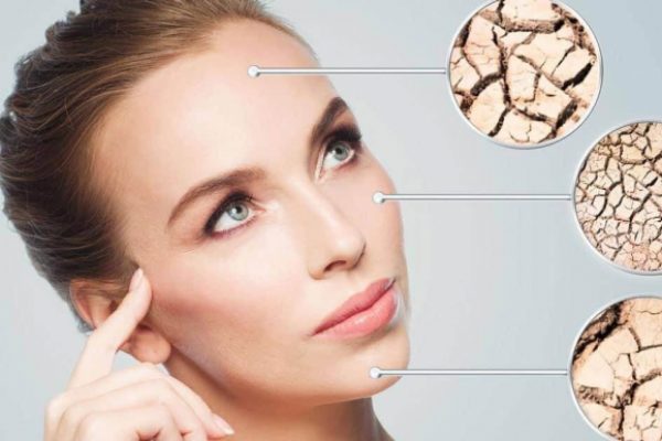 kak-pomoch-pacientu-nepriyatnosti-ochen-suhoy-kozhi-lica-1616767133